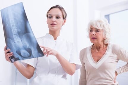 L'examen aux rayons X est une méthode informative pour diagnostiquer l'ostéochondrose de la colonne vertébrale