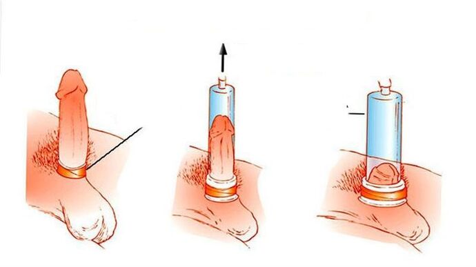 Principes de fonctionnement d'une pompe à vide