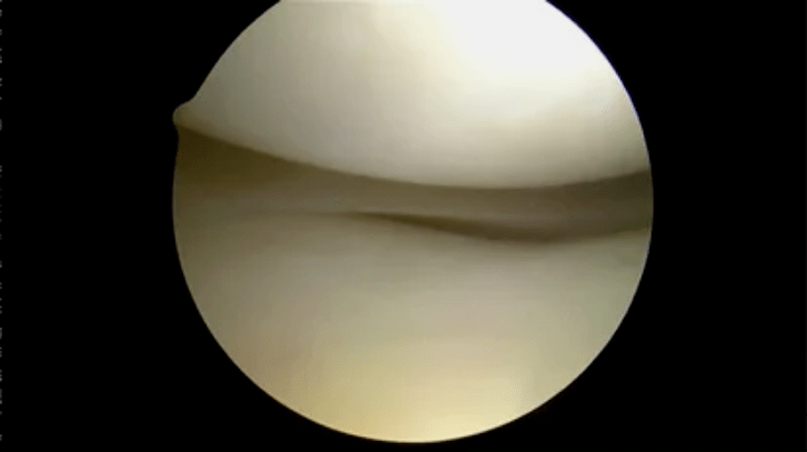 Vue astroscopique de surfaces complètement saines