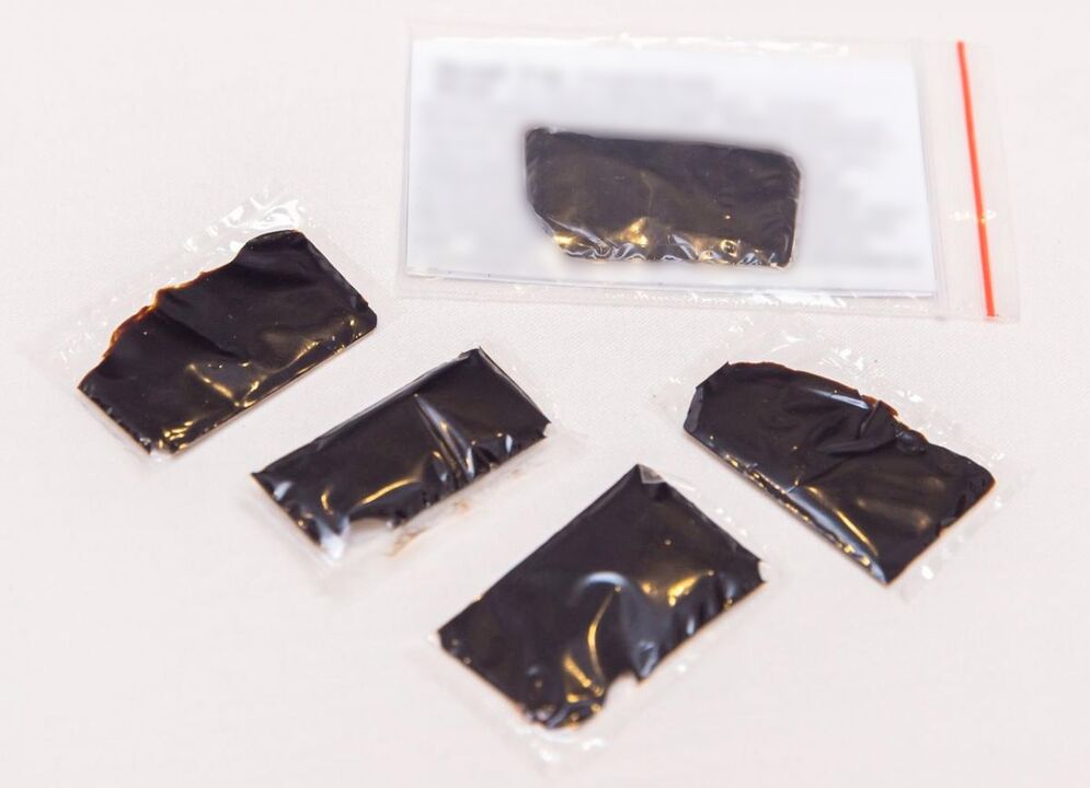 Shilajit est un remède efficace pour traiter l'ostéochondrose cervicale à domicile