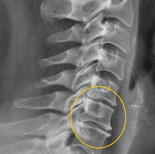 Image de diagnostic